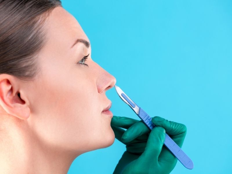 rinoplastinin-temel-amaclari