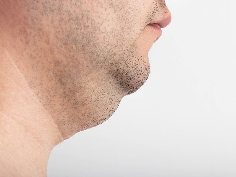 gidi-alma-yontemleri-nelerdir