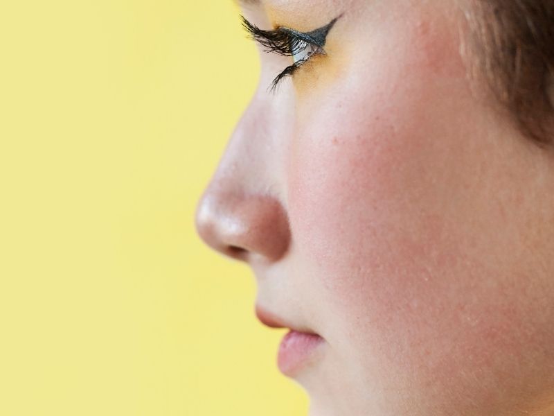 gentle-tip-plasty-nazik-uc-sekillendirme