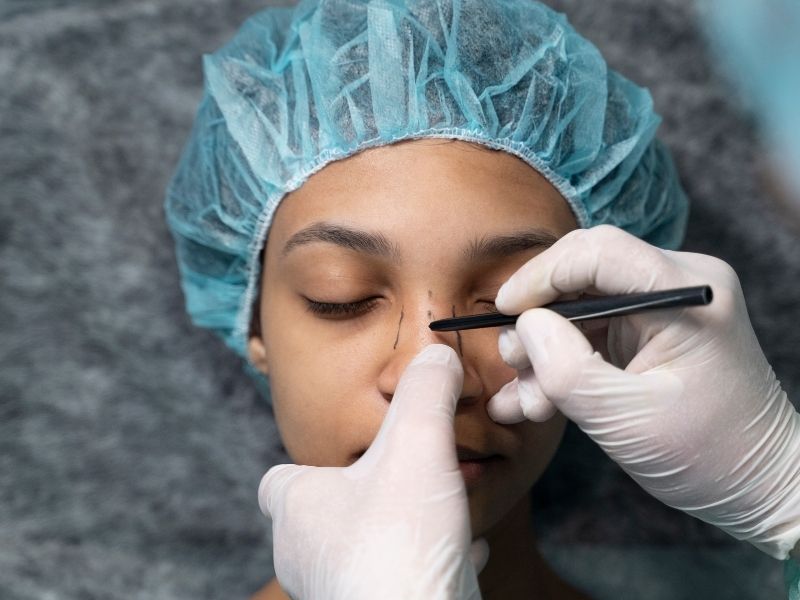 rinoplastide-burun-kemiklerine-neden-mudahale-edilir